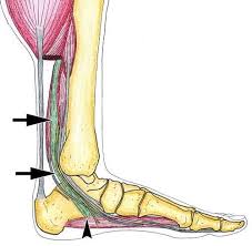 نتیجه جستجوی لغت [accessorius] در گوگل