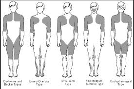 Image result for Μυϊκή Δυστροφία Ντουσέν