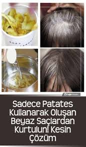 Sadece Patates Kullanarak Olusan Beyaz Saclardan Kurtulun Kesin Cozum Beyaz Sac Sac Dogal Sac Bakimi