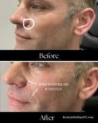 Reclaim Med Spa and Wellness