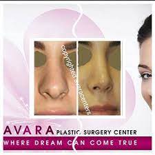 تجميل الانف تكلفة و أسعار عمليات التجميل للأنف أفارا surgery center surgery incoming call screenshot