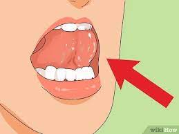 This is when you do something with your tongue and the spit flies right out of your salivary gland underneath your tongue. How To Gleek 11 Steps With Pictures Wikihow