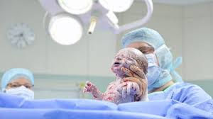 Es ist frappierend, wie deutlich die eingriffe abnehmen, wenn mit dem kaiserschnitt gewartet wird, so groß. Geburt Ablauf Eines Geplanten Kaiserschnitts Babywelten Ch