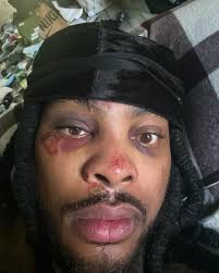 Can't believe nobody helped me fight ten nixxas off but I'm still standing  ten toes marks