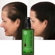 Hair Repair Essence Lotion