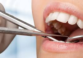 Lon clarke bsc (hons) dmd is one of barbados leading dentist. Barbados Aesthetic Dental Barbados Dentists Yabsta