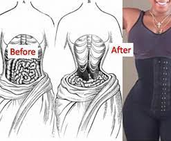 The Dangers Of Kim K S Torturous Waist Training