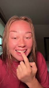 Understanding Your Invisalign Journey as an Adult