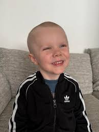 Could any of you great people be able to take strands of hair off my face  and open my sons eyes thank you so much