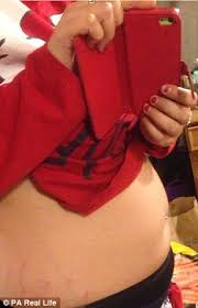 Their consensus is to change your tampon every four to eight hours, says nguyen. Student Who Left A Tampon In For Nine Days Developed Toxic Shock Syndrome Daily Mail Online