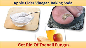 That, plus the fact that all the starting and finishing. How To Get Rid Of Toenail Fungus Apple Cider Vinegar Baking Soda Youtube