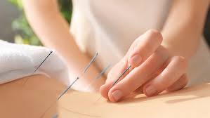 Acupuncture Points for Fertility and Emotional Well-being