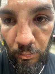 Joseph Sterner's Instagram, Twitter & Facebook