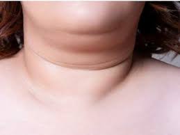 Stretching was most effective when combined with muscle endurance and strength training. Double Chin Exercises Hate Double Chin Do These 7 Exercises To Get Rid Of It In 30 Days Facial Exercises For Double Chin