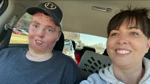 Teenage burn victim given new outlook