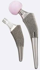 Hip Femoral Stems | Advita Ortho