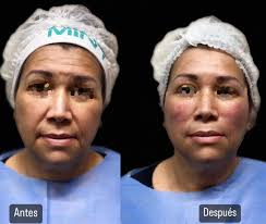 Dr. Omar Nolasco 👨‍⚕️ (@dr_omarnolasco) • Instagram फोटोहरू र भिडियोहरू