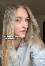 Being Vulnerable About Acne and Skincare