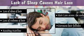 Speaking to allure, francesca j. Hair Art Center Lack Of Sleep Causes Hair Loss Facebook