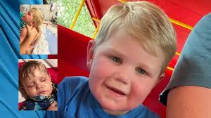 Toddler With One Kidney Stung by Yellowjackets
