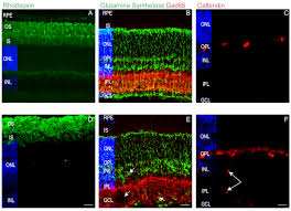 Fewer matches cause the entire re not to match. Preparation Of Mouse Retinal Cryo Sections For Immunohistochemistry Protocol