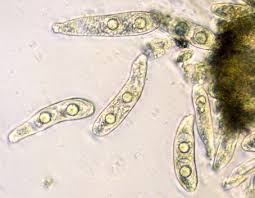 Image result for didymascella thujina