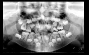 We did not find results for: Caso NÂº 169 Sindrome De Crouzon Cdi Peru