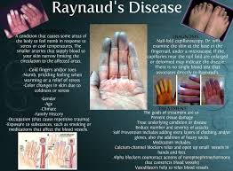 Pin By Judy Hutson Griffith On Health Nutrition Wellness Raynaud S Disease Raynauds Disease