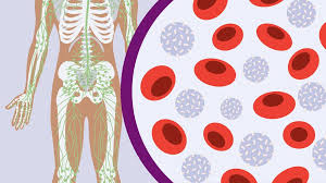 Image result for Leukemia