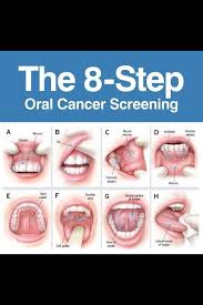 The 8 Step Oral Cancer Dental Hygiene School Dental Anatomy Oral Cancer
