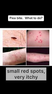 Image result for flea bite
