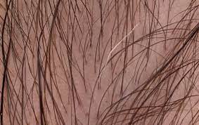 Why is your hair turning white? One Single White Hair Growing From My Arm Mildlyinteresting