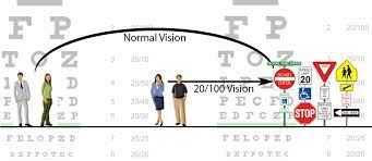 20 20 Vision Is The Clarity Or Sharpness Of Vision Measured At A Distance Of 20 Feet 20 20 Does Not Necessarily Mean Eye Exercises Vision Eye Food For Eyes