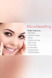 ✨ Microneedling Magic at Cariad...