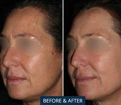 Jacksonville Plastic Surgery, 3599 University Blvd S, Jacksonville, FL  32216, US