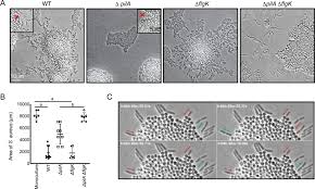 The bacteria takes advantage of an individual's weakened immune system to create an infection and this organism also produces. Interspecies Interactions Induce Exploratory Motility In Pseudomonas Aeruginosa Elife