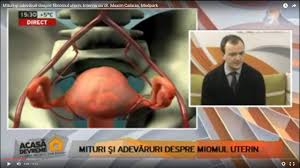 Fibromul uterin este cea mai frecventa tumora benigna a uterului, aproximativ 20% dintre femei prezentand aceasta afectiune, afectiunea fiind totusi intalnita mai frecvent la femeile care au depasit varsta de 30 ani. Mituri Si AdevÄruri Despre Fibromul Uterin Interviu Cu Dr Maxim CalaraÈ Medpark Youtube