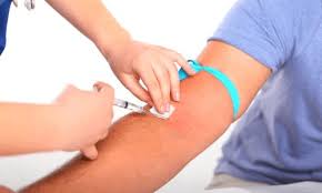 Najbolje je ostati kod kuće nakon operacije i ne raditi nekoliko dana. Sto Se Moze Uciniti Ako Se Modrica Pojavila U Ruci Nakon Ubrizgavanja Kako Tretirati Modrice Nakon Uzimanja Krvi Iz Vene Krvi Iz Beca Ostala Je Modrica