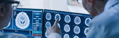 Mooci Hirntumor Das Sind Die Heilungschancen