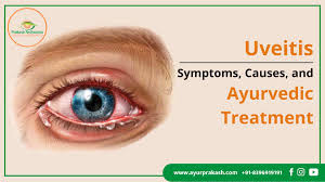 Image result for Uveitis