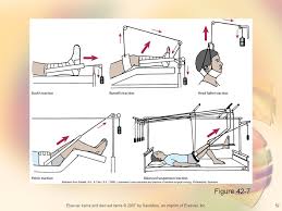 Femoral traction splints in mountain rescue prehospital care: Chapter 42 Fractures Ppt Video Online Download