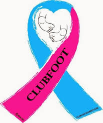 Check out this short video to find out. The Clubfoot Chronicles It S World Clubfoot Day