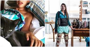 Fake followers, likes, engagement, comments, stories, audience, demographic info, advertisers, brands. Guerreira Tetraplegica Lais Souza Surpreende Ao Mexer O Ombro