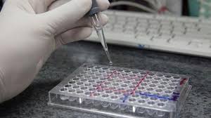 Biaya Rapid Test Antigen Terbaru Resmi Ditetapkan Kementerian Kesehatan Dan Bpkp Tribun Manado