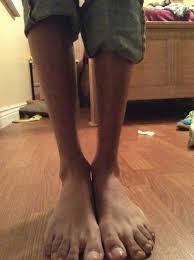 Your slender feet stock images are ready. I Have Really Skinny Legs Ankles And I Hate It Is There Anything Possible I Can Do Please Photos