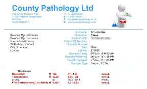 My 2018 Blood Test Results And Trt Protocol Changes The