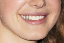 Lana Del Rey S Gold Tooth Diamond Teeth Teeth Jewelry Gold Tooth Cap