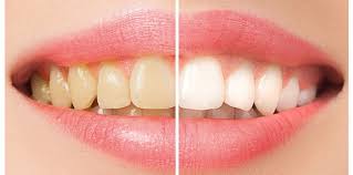 Merupakan mukosa mulut yang menutupi tulang maksila dan mandiula di dalam rongga mulut. Fungsi Gigi Kacip Bukan Sekadar Untuk Mengigit Sahaja Ini Peranannya