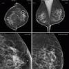 While it may look like a fuzzy, spotty television screen with different shades of grey to a patient, the ultrasound technician and the radiologist use these images to diagnose masses and tumors. 1