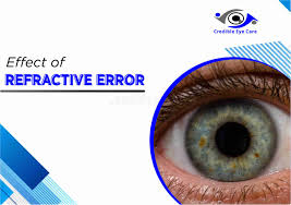 Image result for Refractive Error